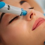 Hydrodermabrasion: all you need to know
